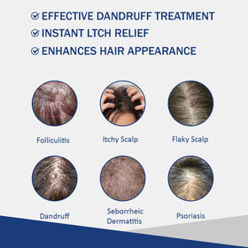 Danliss active ingredients label highlighting doctor-developed scalp support