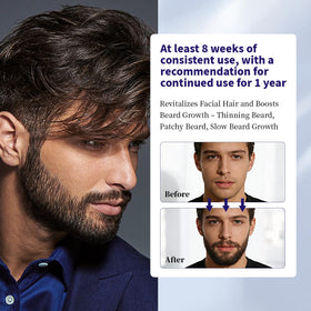 Man applying Danliss to scalp to promote thicker-looking hair
