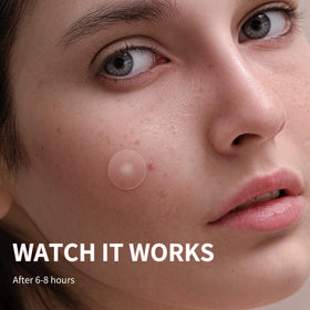 Daolyo three sizes 8mm 10mm 12mm display to match different blemish sizes