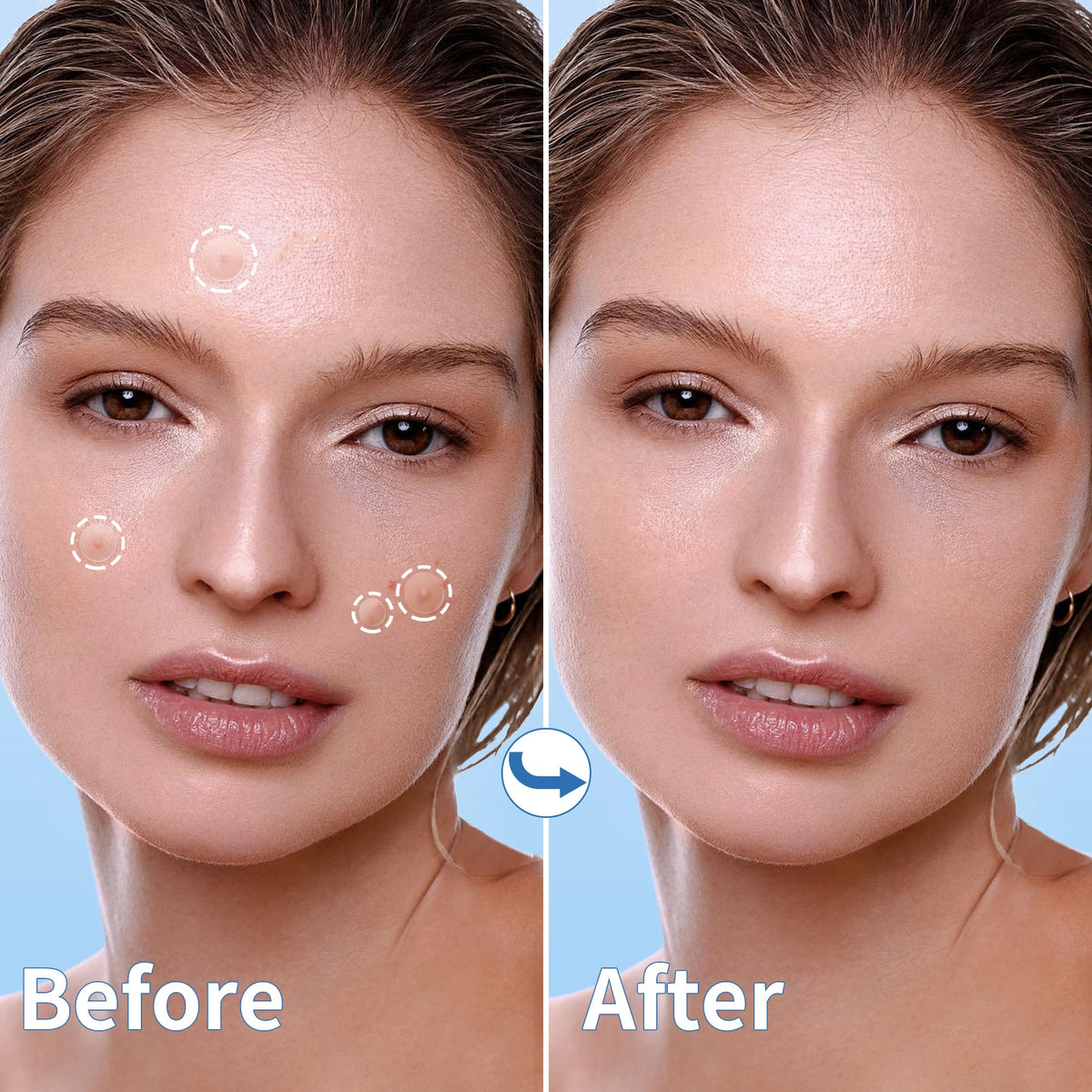 Daolyo patch on cheek demonstrating discrete coverage and confidence