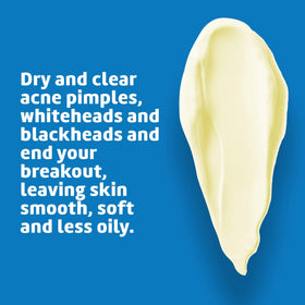 De La Cruz applied to cheek showing targeted spot treatment benefit