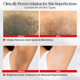 Dear Kitty ingredient graphic with tranexamic acid and niacinamide benefits