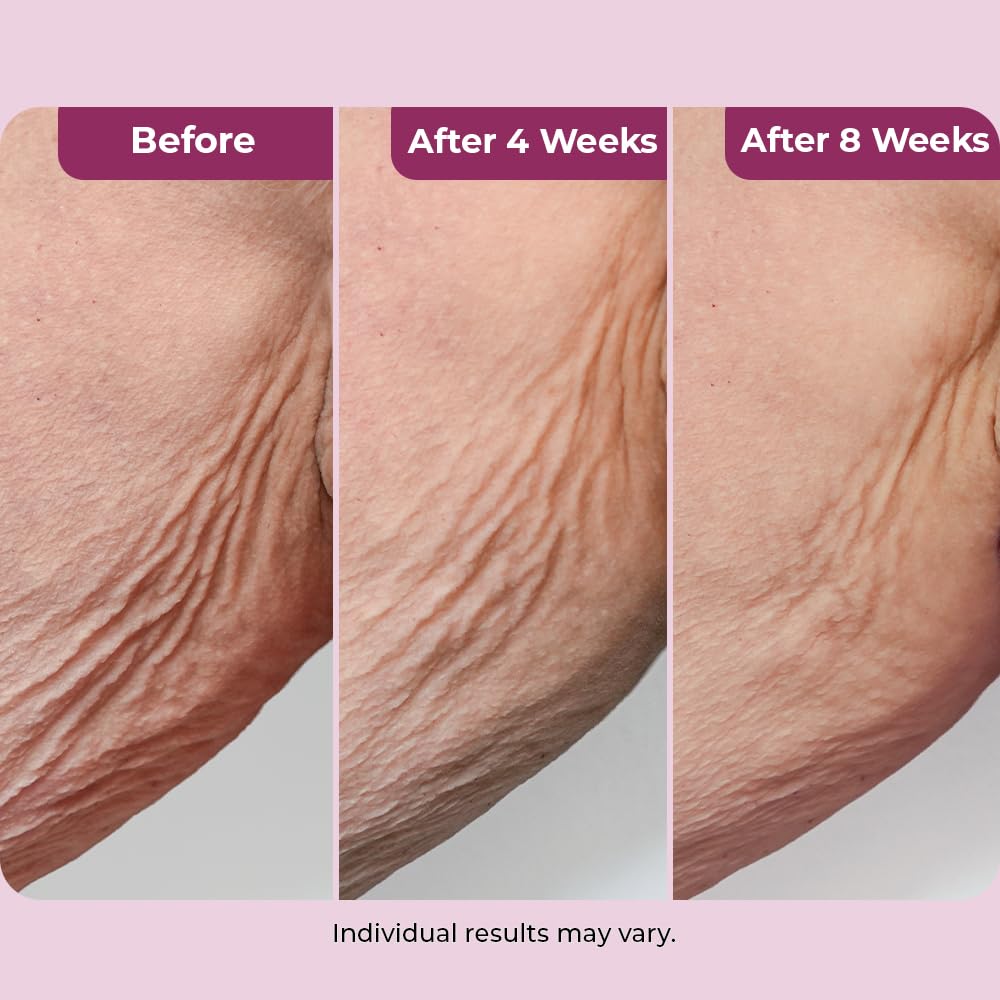 DEKLIDERM applied to neck from hand demonstrating easy absorption and lifting benefit