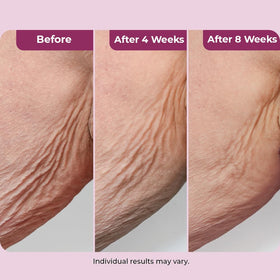 DEKLIDERM applied to neck from hand demonstrating easy absorption and lifting benefit