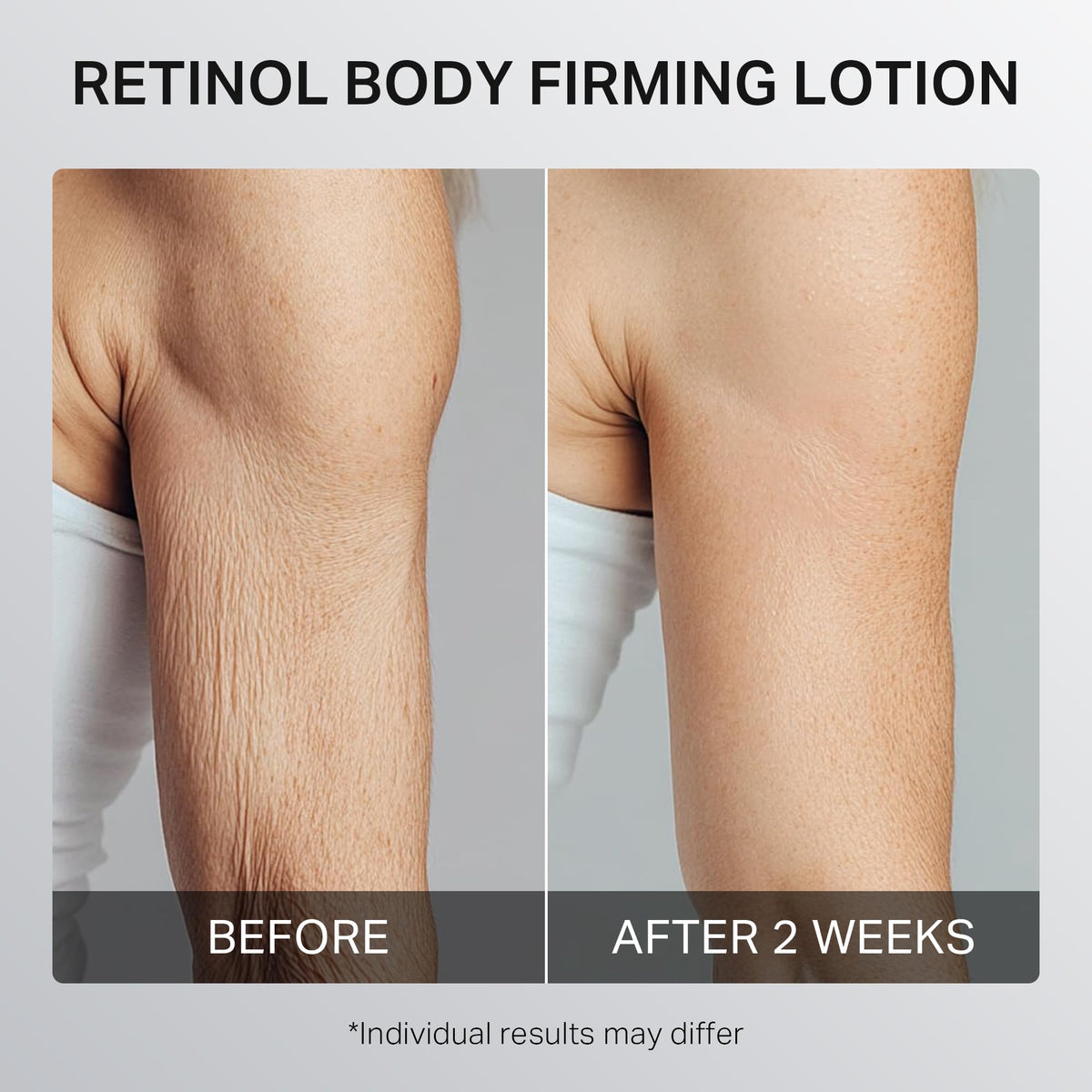 depology lotion applied on thigh illustrating improved skin appearance
