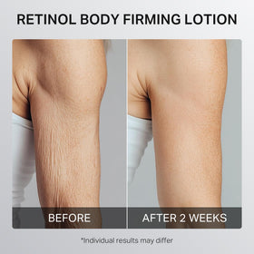 depology lotion applied on thigh illustrating improved skin appearance
