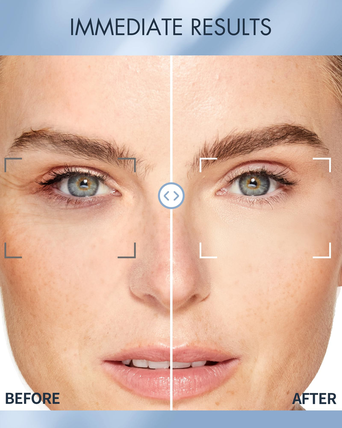 depology patch applied under eye, demonstrating immediate hydrating effect benefit