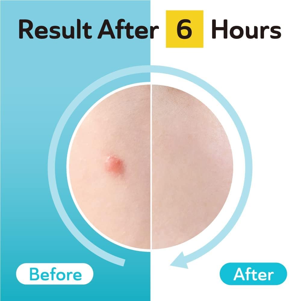 DERMA ANGEL opened packet with 96 patches arranged showing quantity convenience benefit