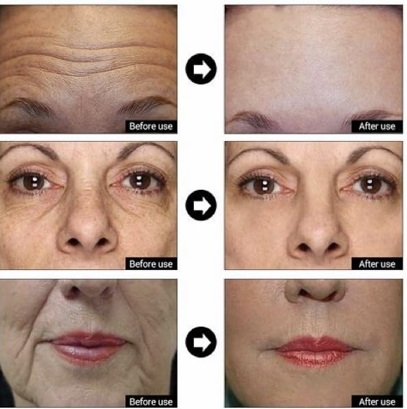 DERMA CLINICALS size comparison and label showing ingredient highlights and pump packaging benefit