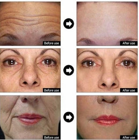 DERMA CLINICALS size comparison and label showing ingredient highlights and pump packaging benefit