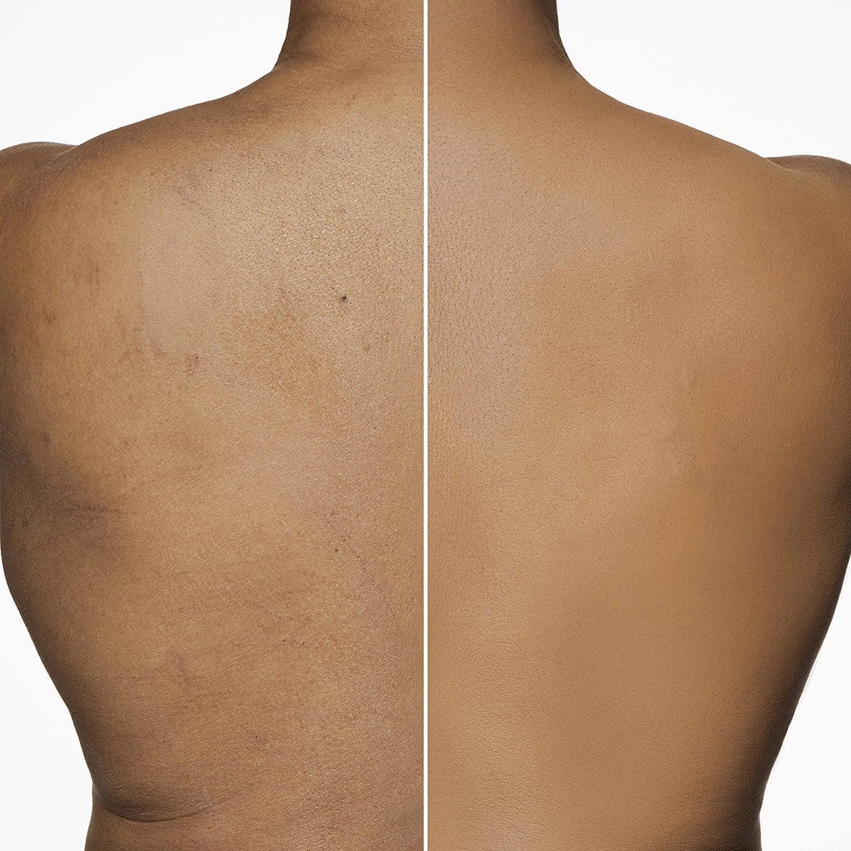 Dermablend label and SPF 25 marking emphasizing sun protection benefit