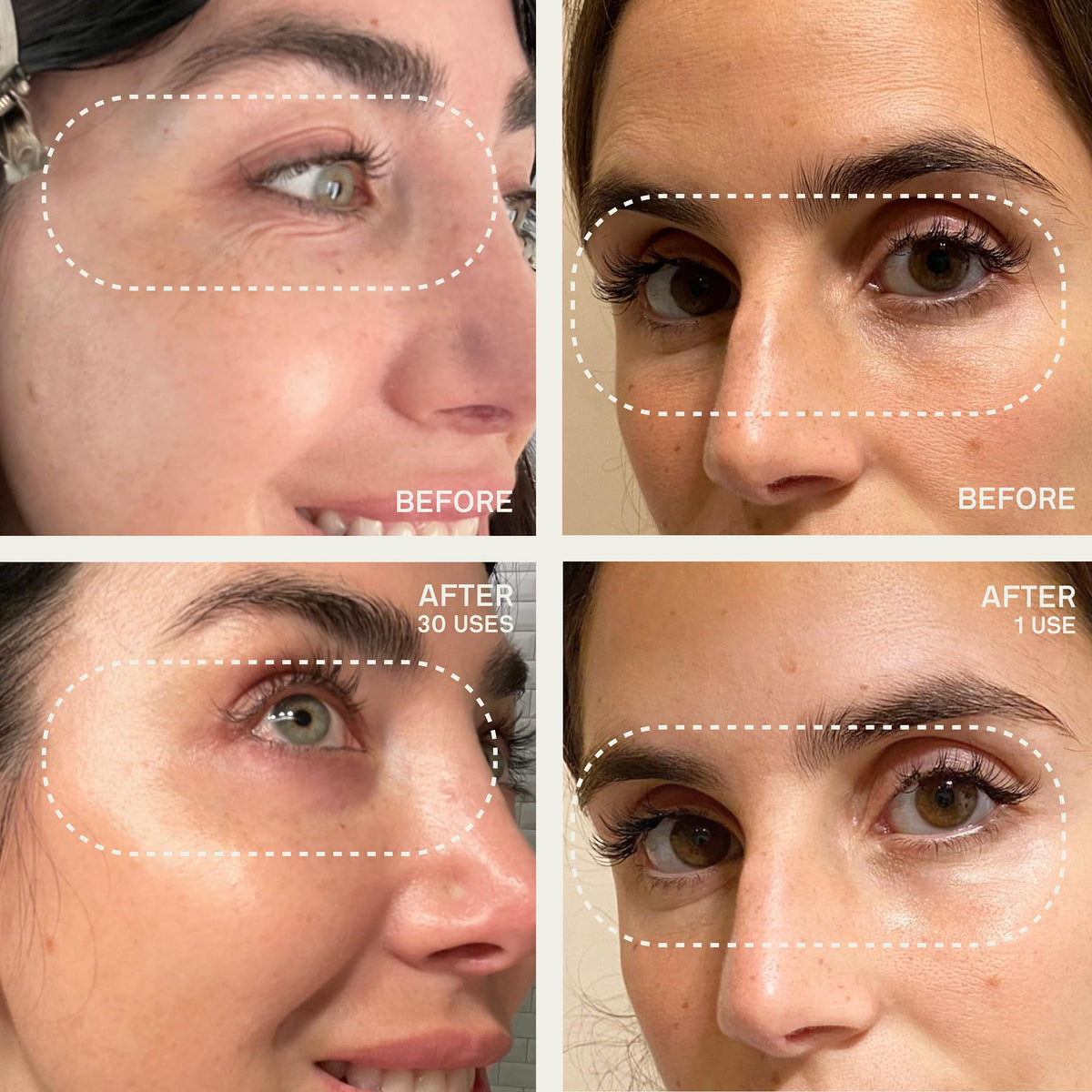 Dermaclara eye and mouth patches detail highlighting reusable design