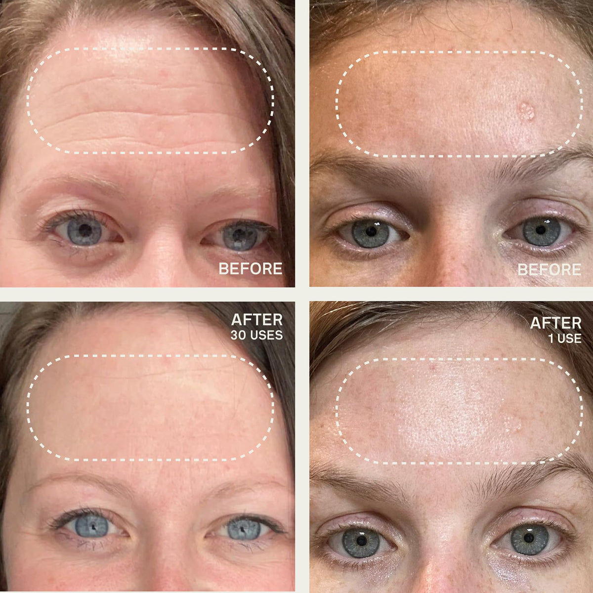 Dermaclara patch under eye showing targeted moisture retention