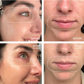 Dermaclara patch worn under eye in mirror for instant hydration and smoothing benefit