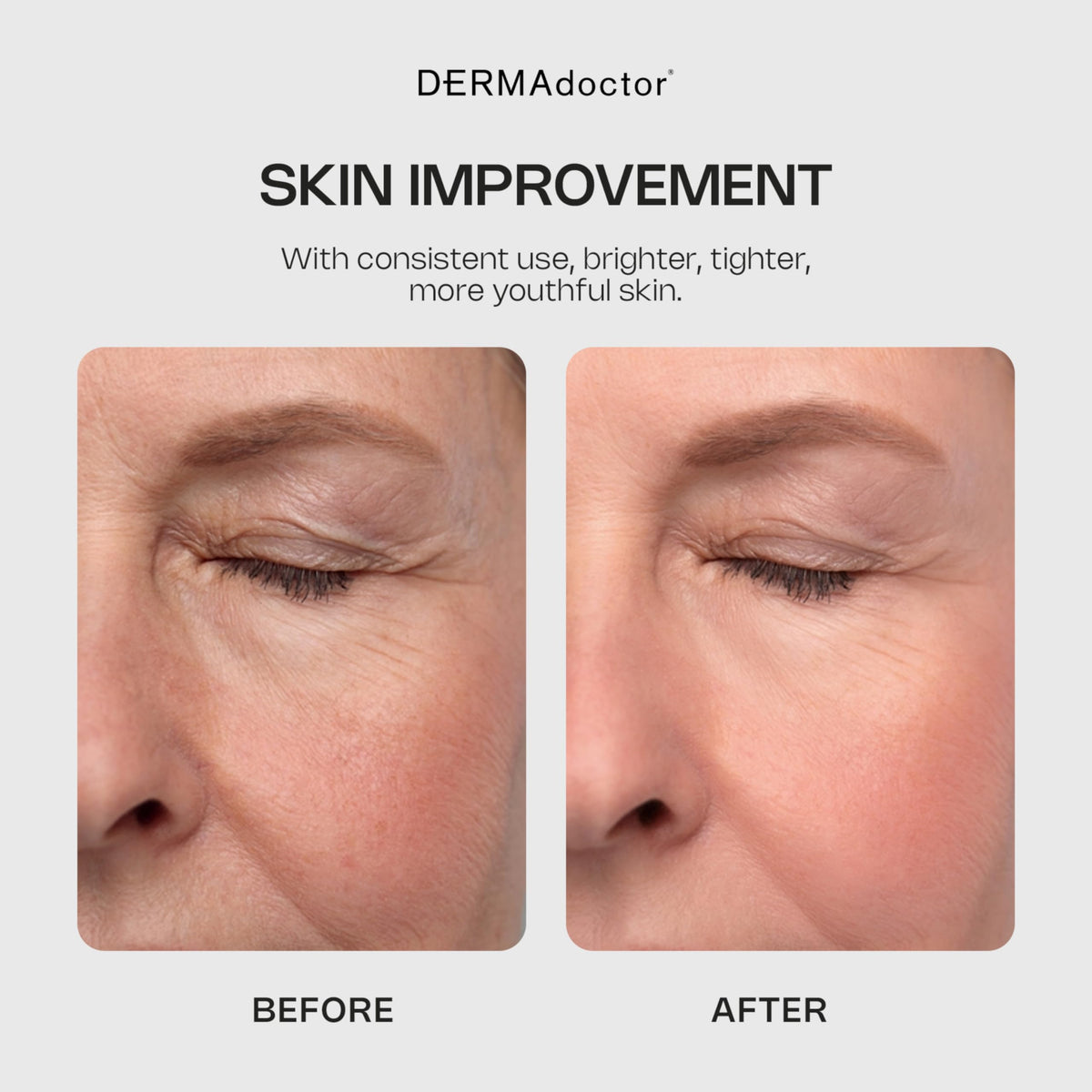 DERMAdoctor applying cleanser to cheek to reveal smoother skin benefit