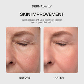 DERMAdoctor applying cleanser to cheek to reveal smoother skin benefit