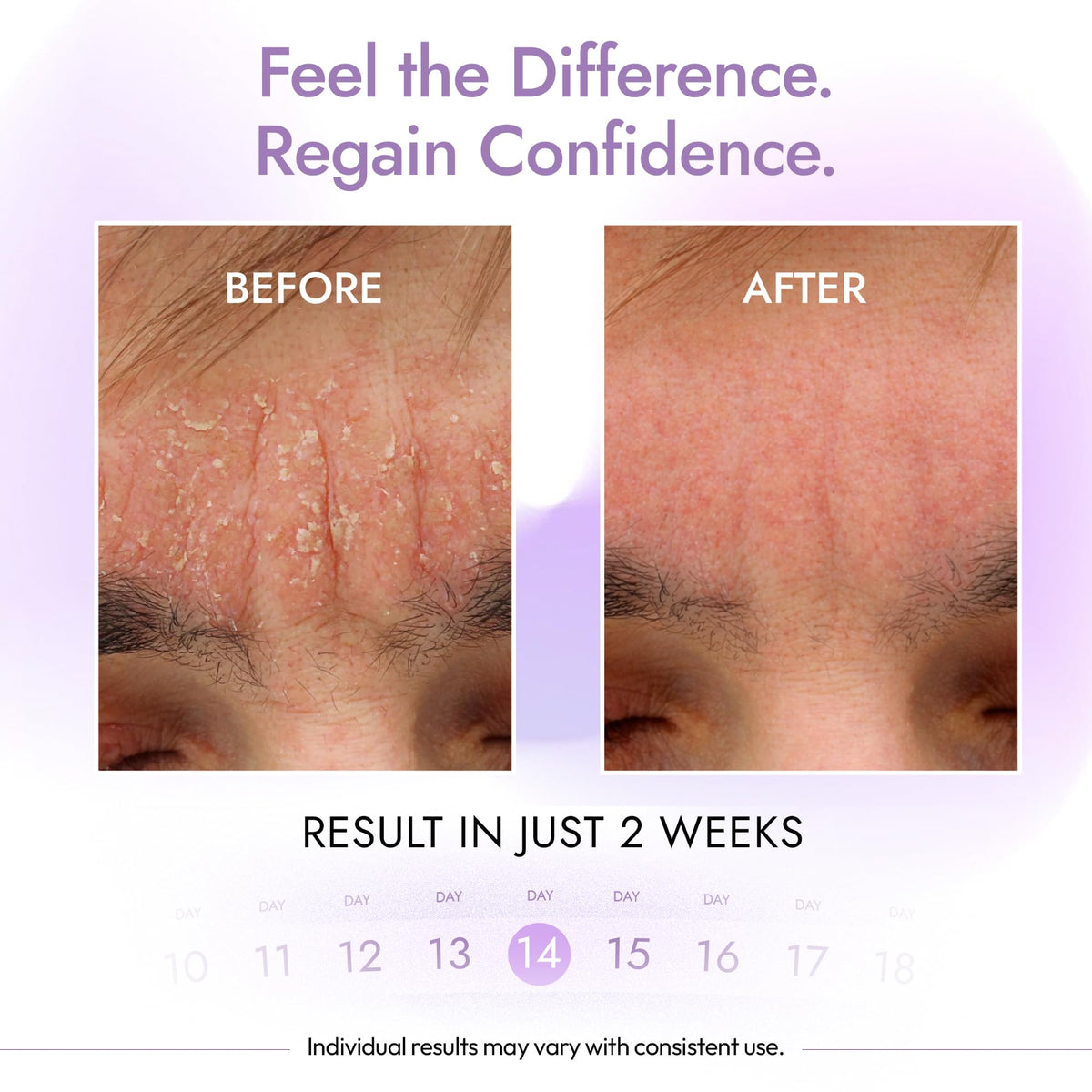 DERMAdoctor applying cleanser to scalp showing targeted use benefit: multi-area treatment
