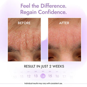 DERMAdoctor applying cleanser to scalp showing targeted use benefit: multi-area treatment