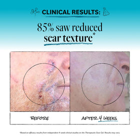 Derma E gel being applied to facial scar to hydrate and smooth skin