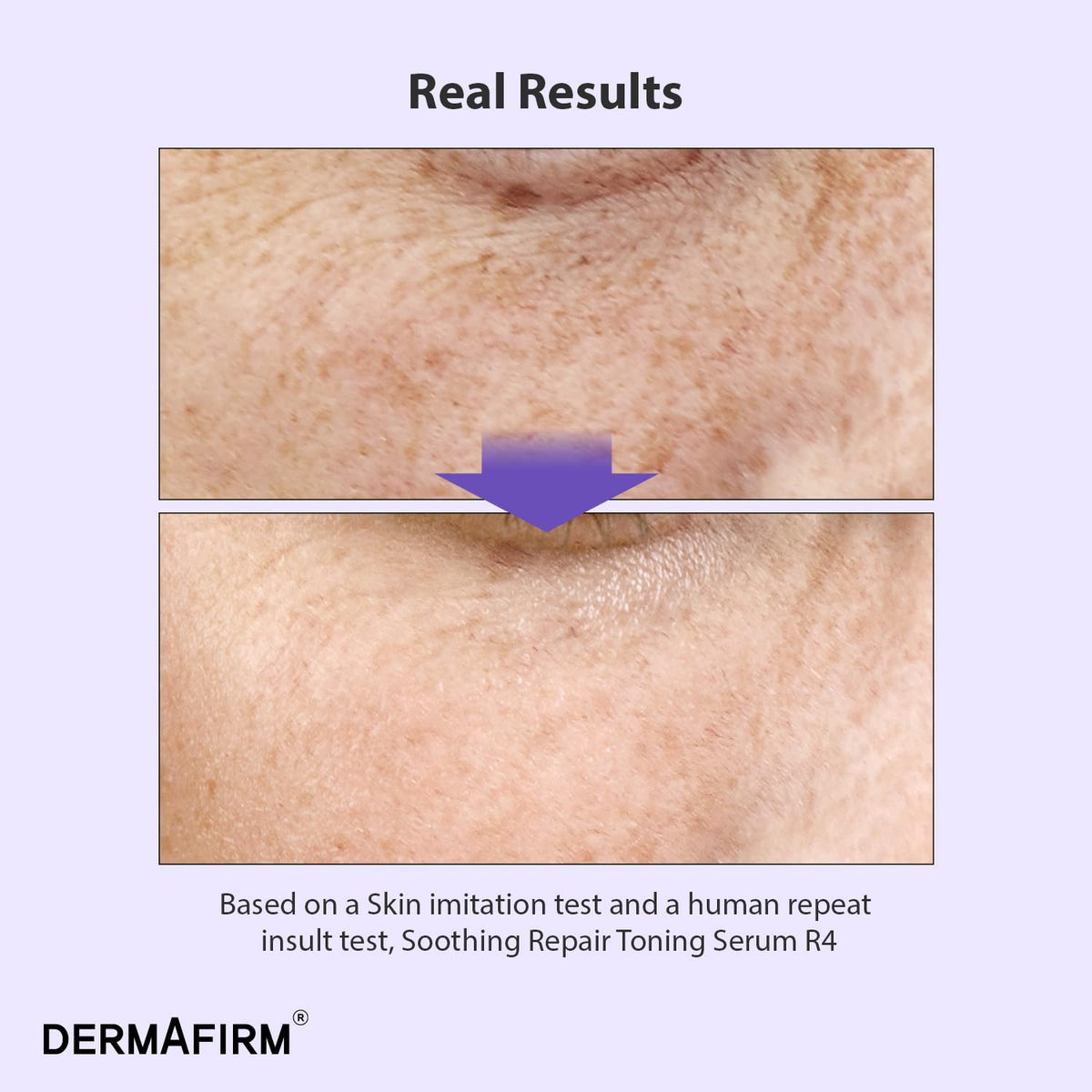 Dermafirm dropper dispensing serum to show controlled application and precision