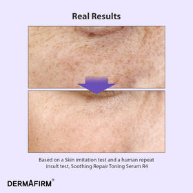 Dermafirm dropper dispensing serum to show controlled application and precision