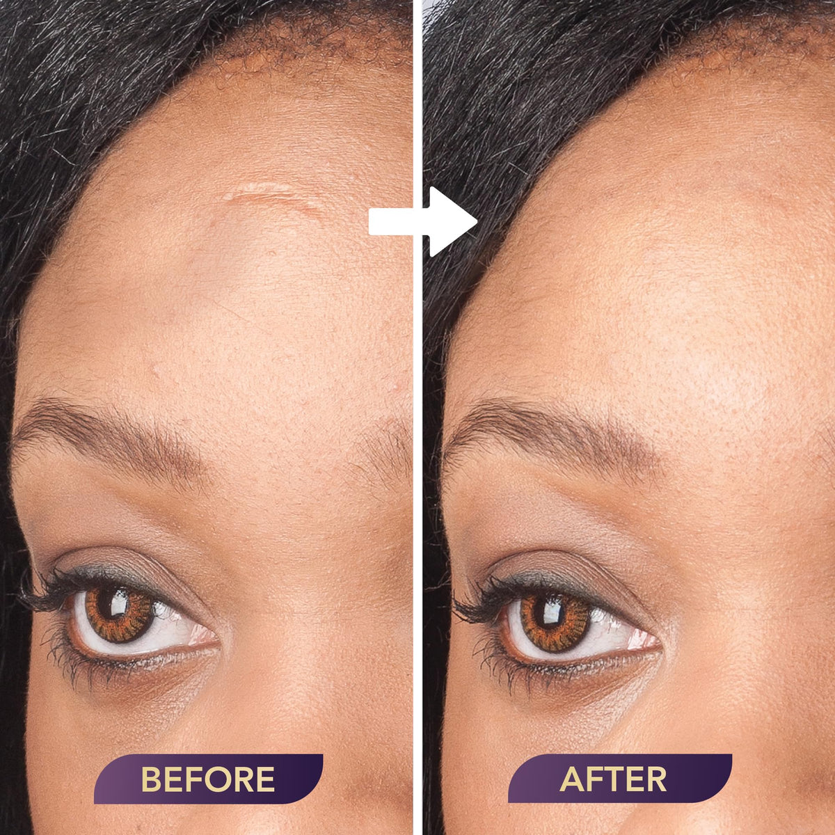 Dermaflage primer before and after application on wrist, shows longer-lasting concealment