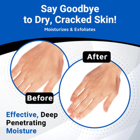 Dermal Therapy being applied to elbow to smooth rough skin effectively