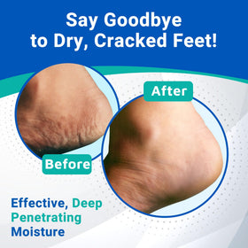 Dermal Therapy label close-up listing 25% urea and 6% AHA benefits