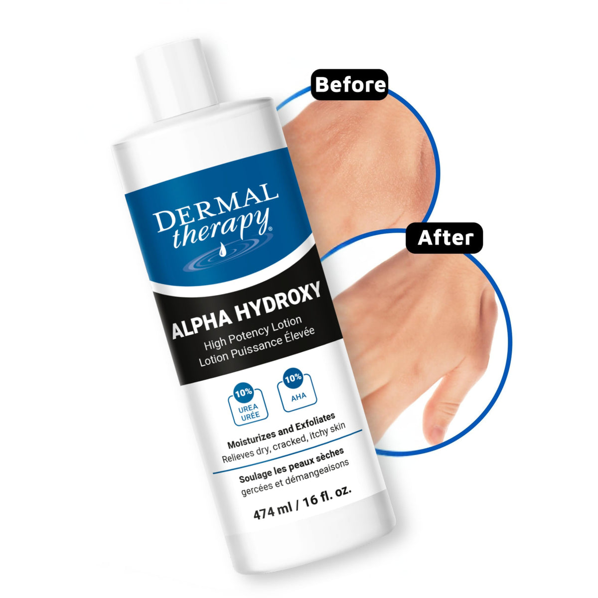 Dermal Therapy ingredient visual with urea and lactic acid for exfoliation benefit