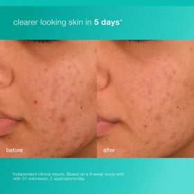 Dermalogica pump dispensing product showing easy, controlled use benefit