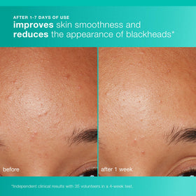 Dermalogica AGE Bright Clearing Serum dropper releasing a clear targeted formula