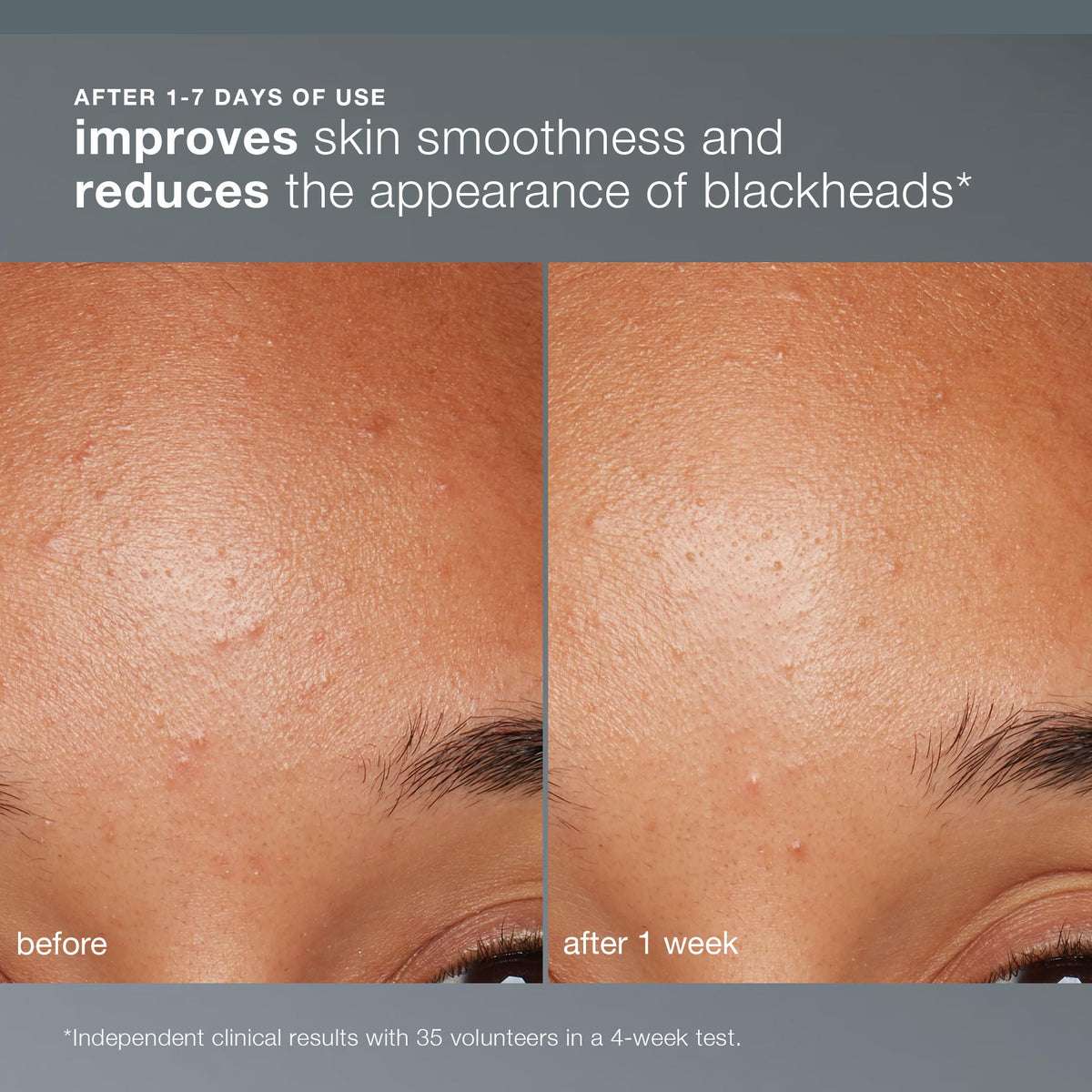 Creamy paste of Dermalogica Daily Microfoliant in palm demonstrating easy activation and control
