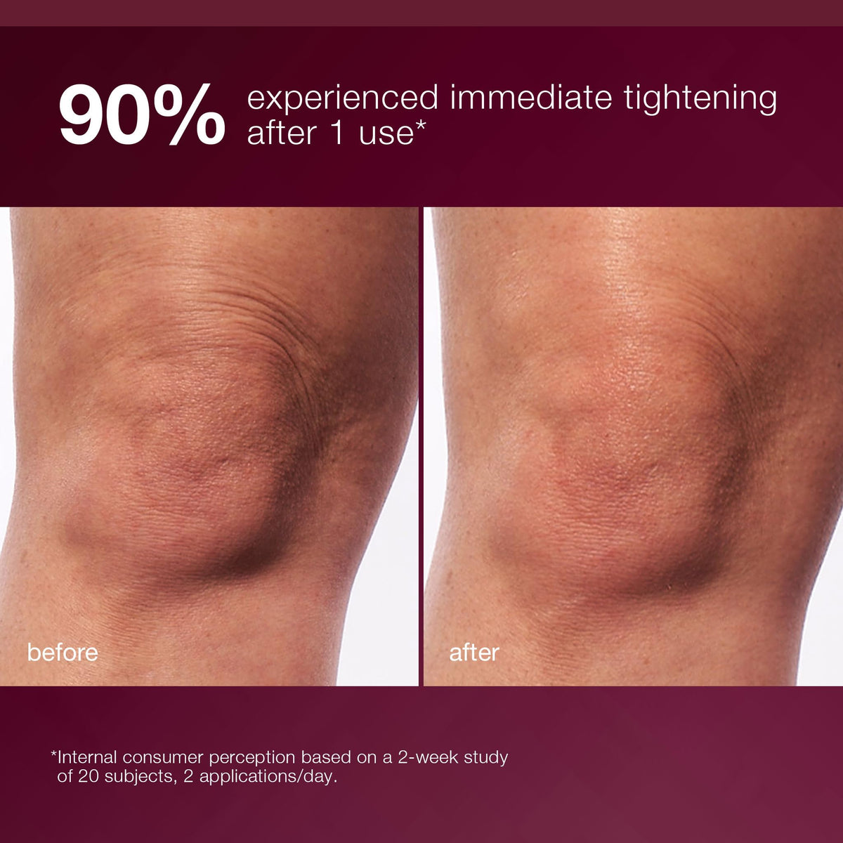 Dermalogica applying serum to arm demonstrating firming massage motion and hydration