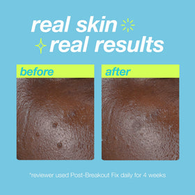 Dermalogica jar open with gel-cream inside showing product consistency and nourishing properties