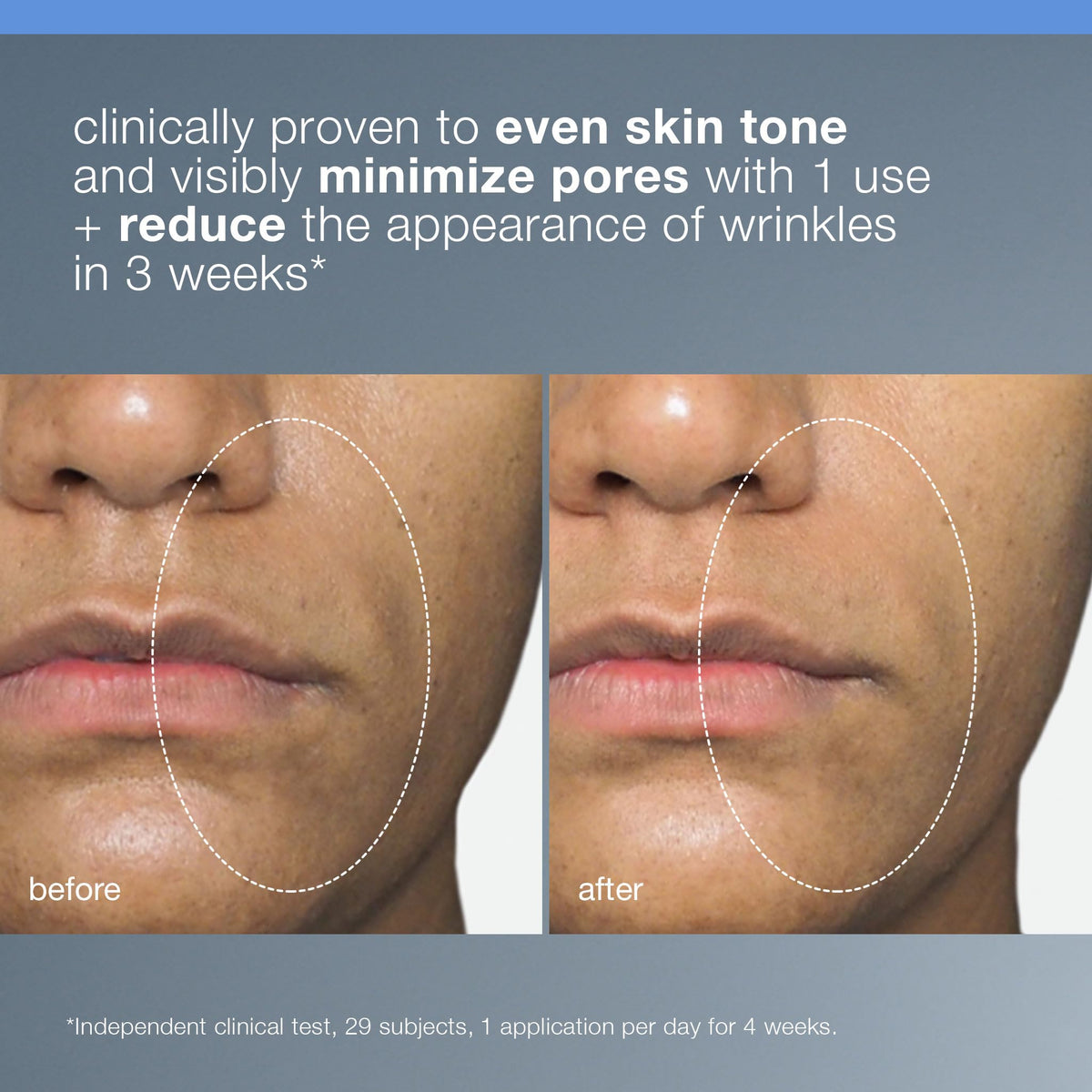 Dermalogica being applied to hand demonstrating targeted exfoliation benefit