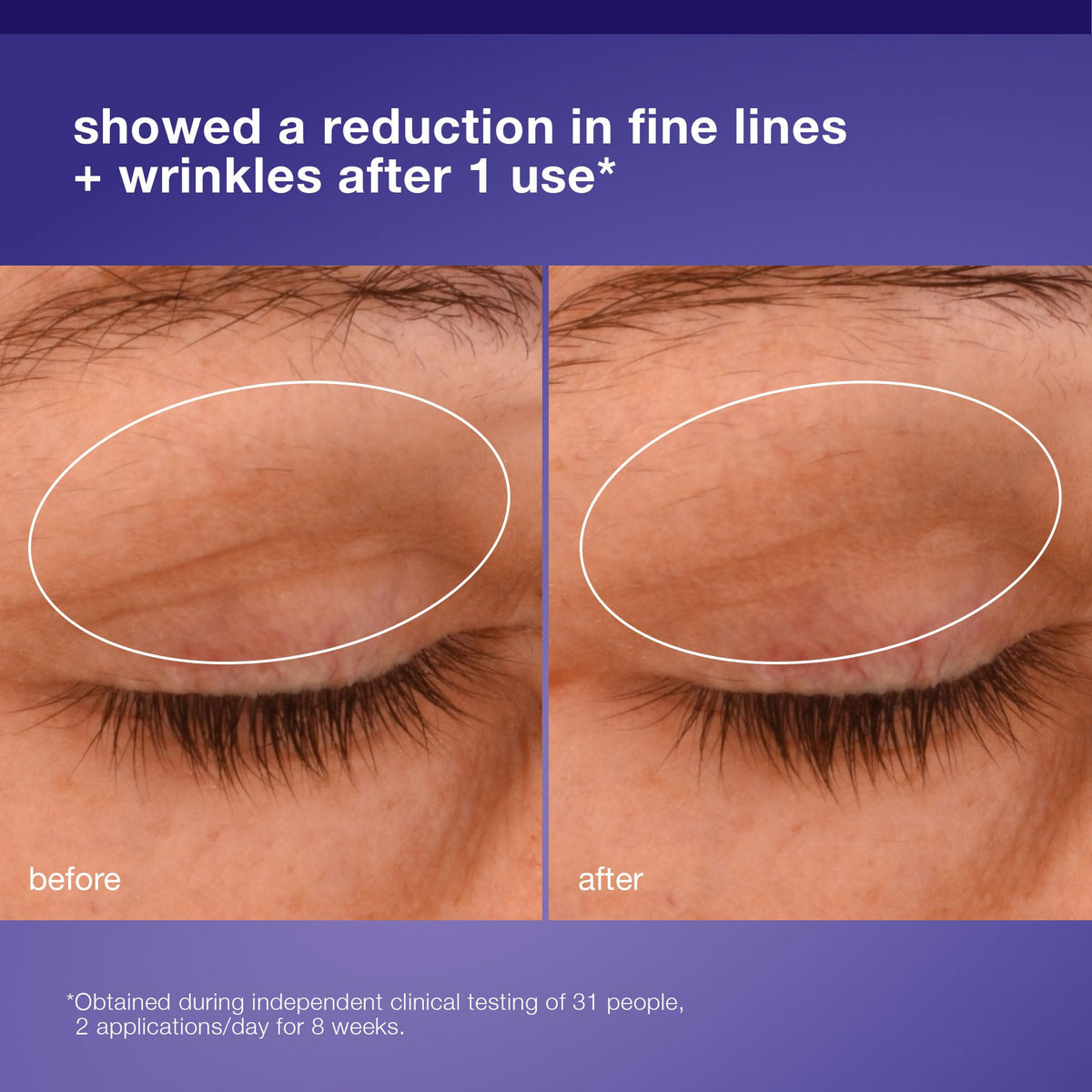 Dermalogica application demo patting cream under eye to lift