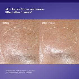 Dermalogica cream being dispensed demonstrating easy application benefit