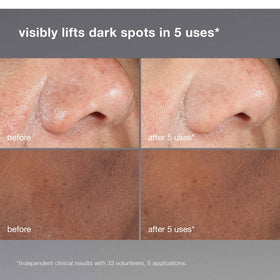 Dermalogica ingredients label close-up highlighting active acids and brightening actives