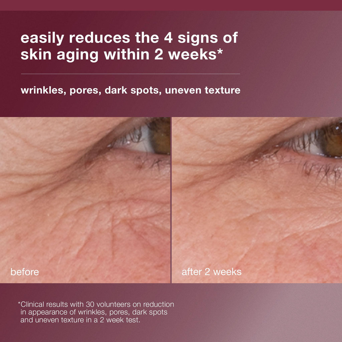Dermalogica serum texture on skin highlighting lightweight absorption benefit