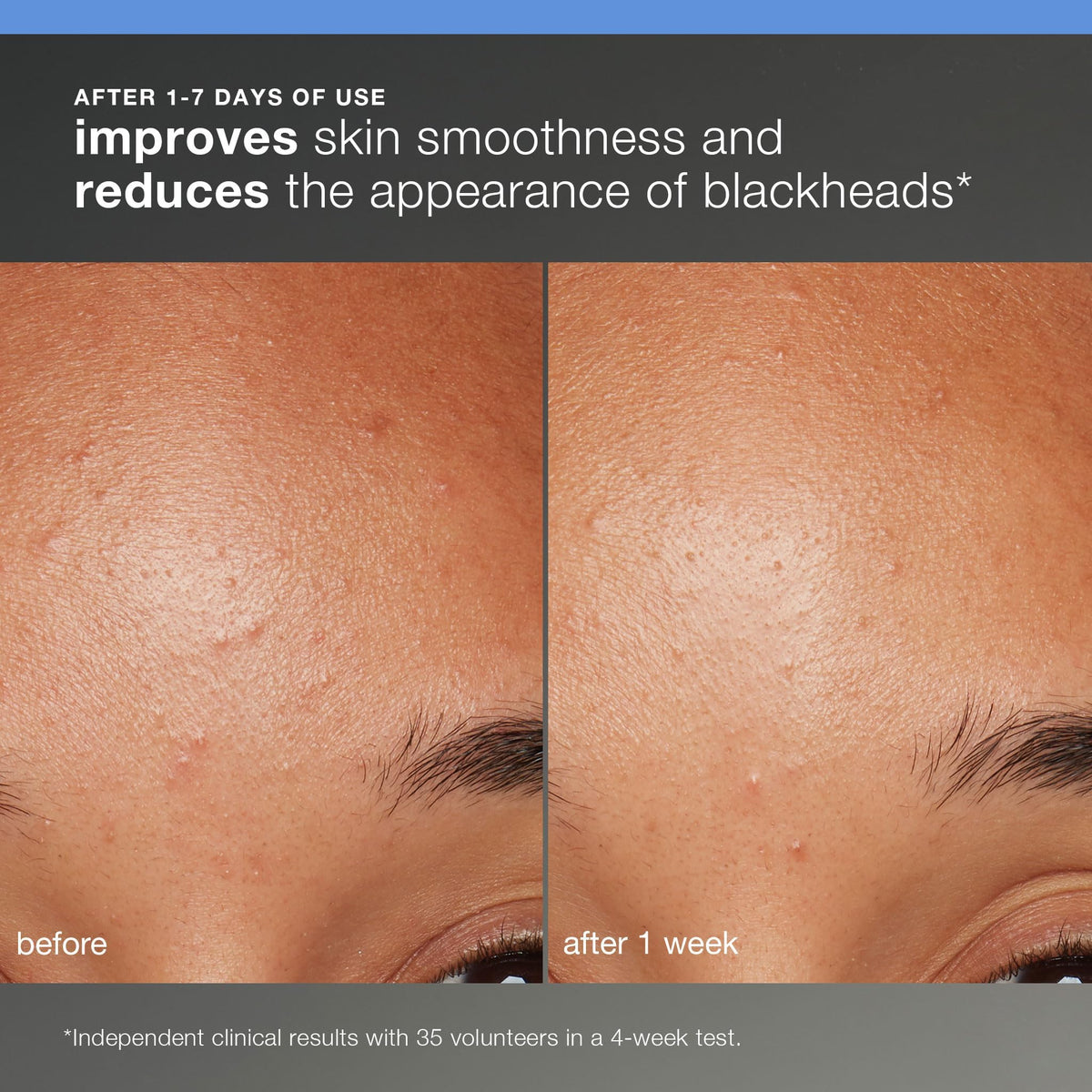 Dermalogica Skin Smoothing Cream open jar showing rich hydration for softer skin