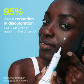Dermalogica spot application on cheek illustrating targeted treatment to visibly reduce dark marks