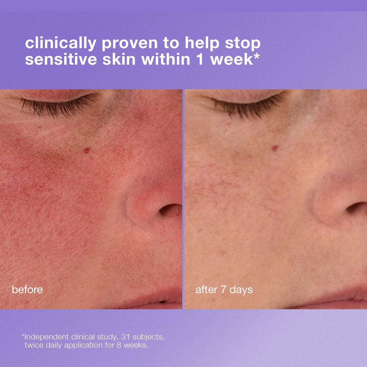 Dermalogica cream applied on hand demonstrating quick-absorbing hydration