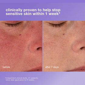 Dermalogica cream applied on hand demonstrating quick-absorbing hydration
