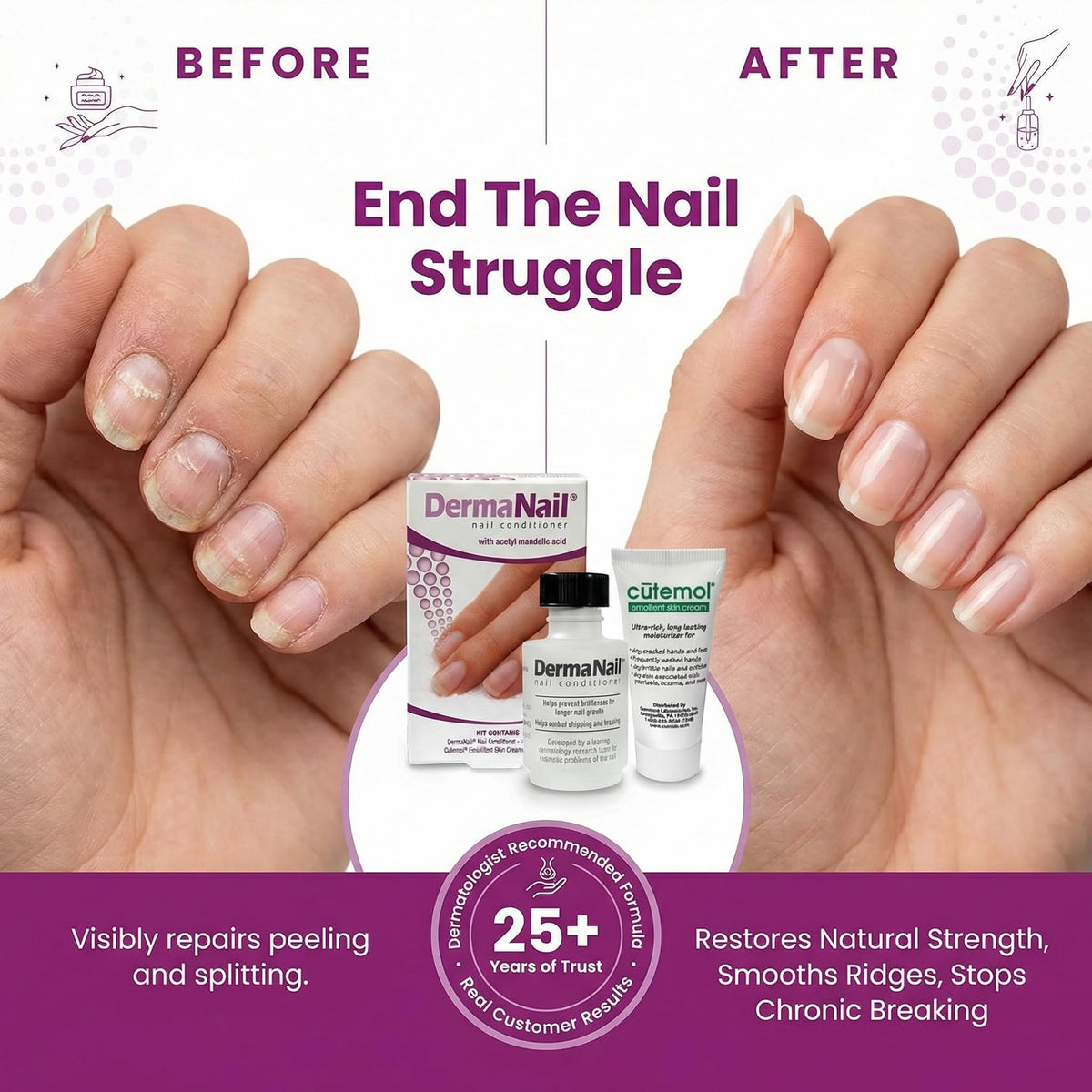 DermaNail Cutemol 11.5g sample tube moisturizing cuticles and skin