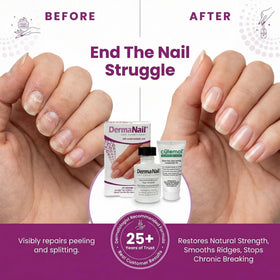 DermaNail Cutemol 11.5g sample tube moisturizing cuticles and skin