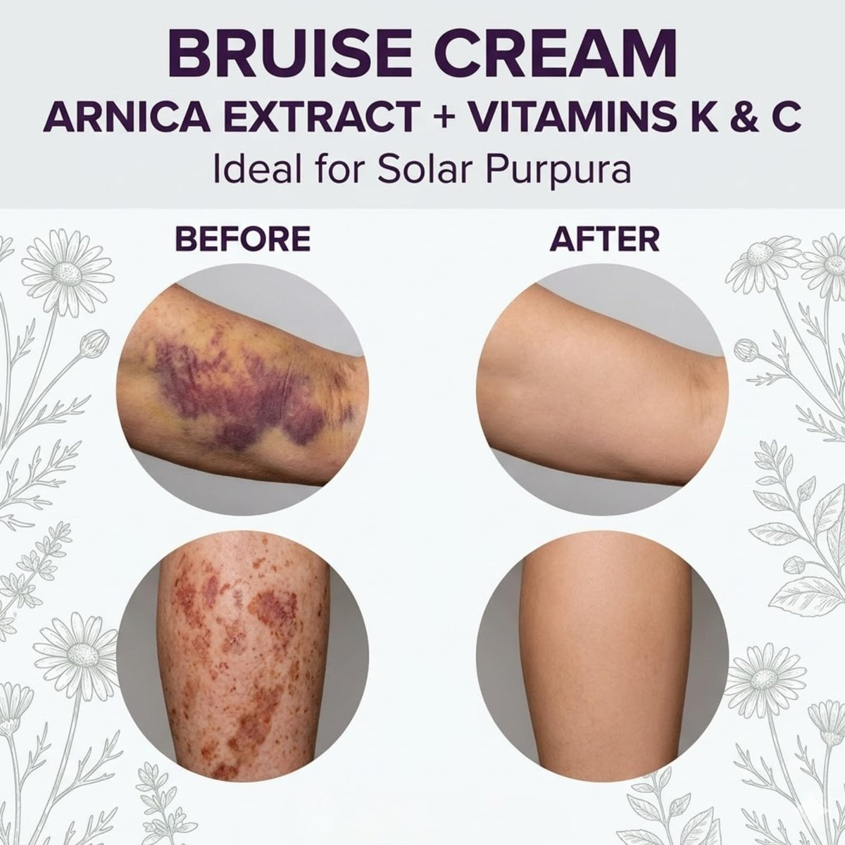 Dermara applied on forearm demonstrating targeted care for fragile skin