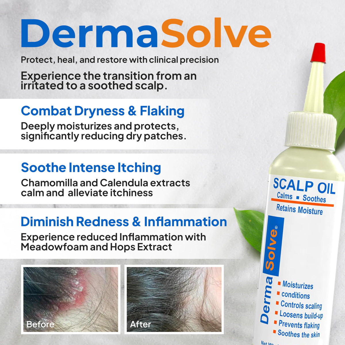 Dermasolve open bottle with dropper dispensing controlled oil