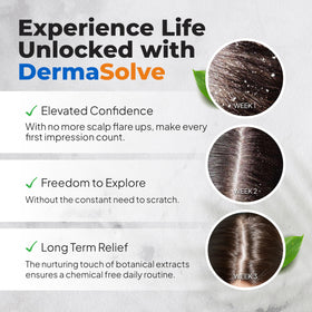 DermaSolve shampoo in hand during use demonstrating gentle lathering benefit
