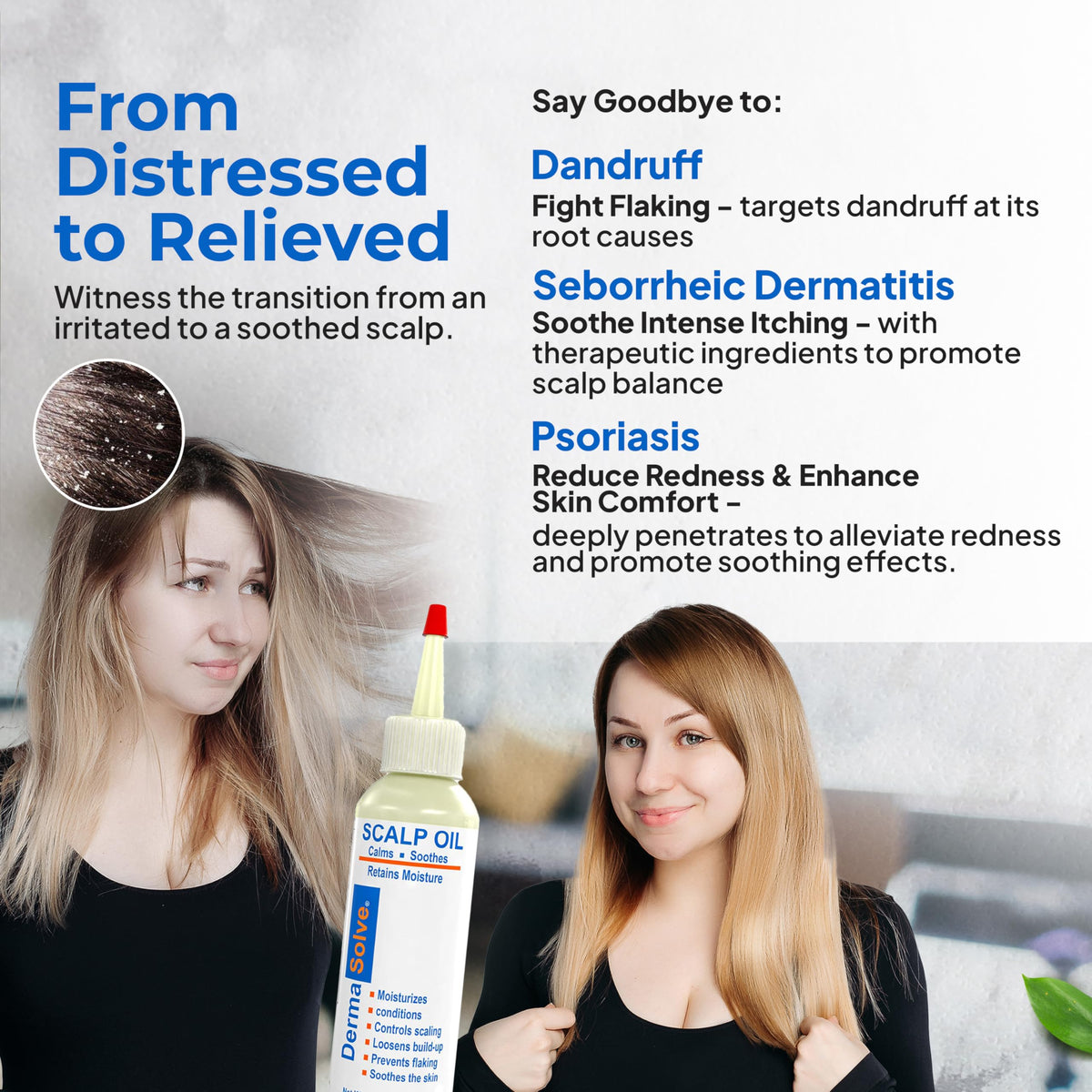 Dermasolve bottle in hand showing bottle size and easy dosing benefit