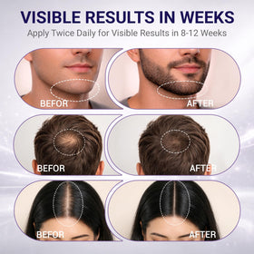 Dermasophia label closeup showing formulation details and stability benefit